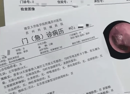 江蘇一女子稱因與快遞員發生口角，被其掌摑導致耳膜穿孔；快遞網點負責人：對方辱罵在先，且一直辱罵，涉事快遞員已被停職